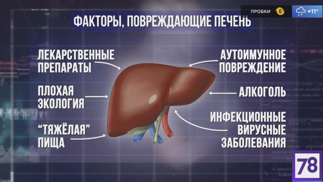 Рак печени