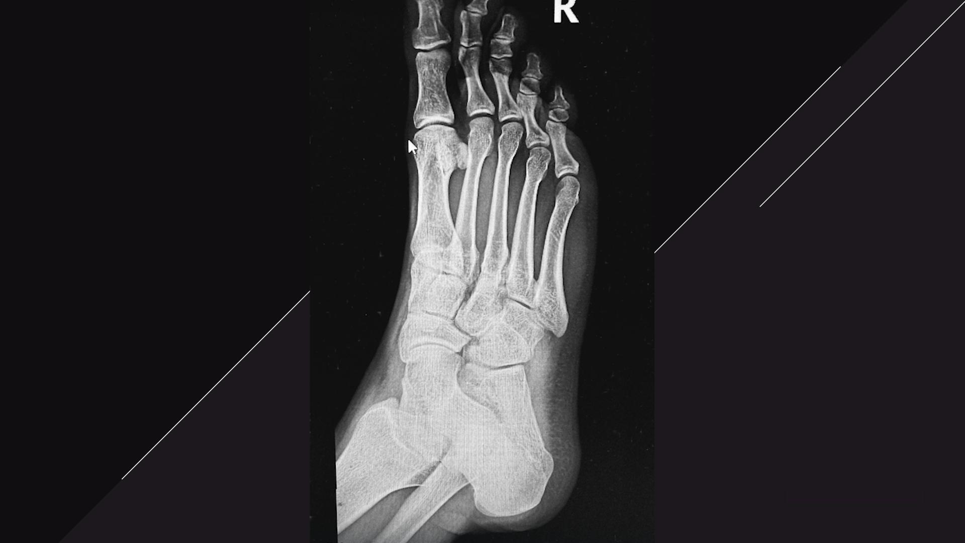 Фото: t.me egorkreed